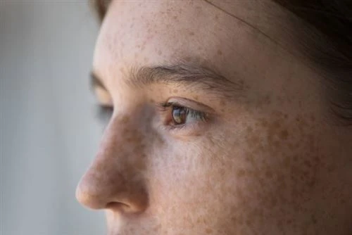 Does CoQ10 Remove Dark Spots?